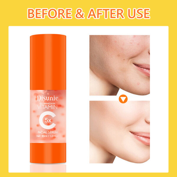 Vit C Face Serum Facial Whitening Brightening Hyaluronic Acid Collagen Vitamin C Dark Spot Corrector Anti-Aging Serums For Face - Image 2